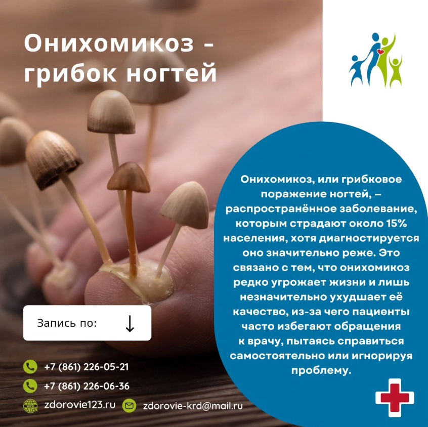 Онихомикоз - грибок ногтей